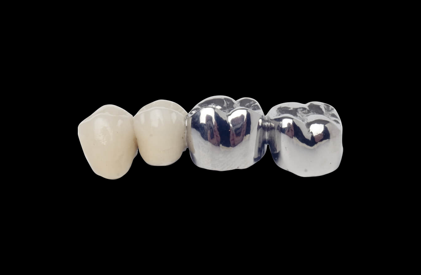 Co-Cr Crown (Cobalt-Chrome)